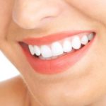 Tips Memutihkan Gigi Secara Alami Tanpa Harus ke Dokter