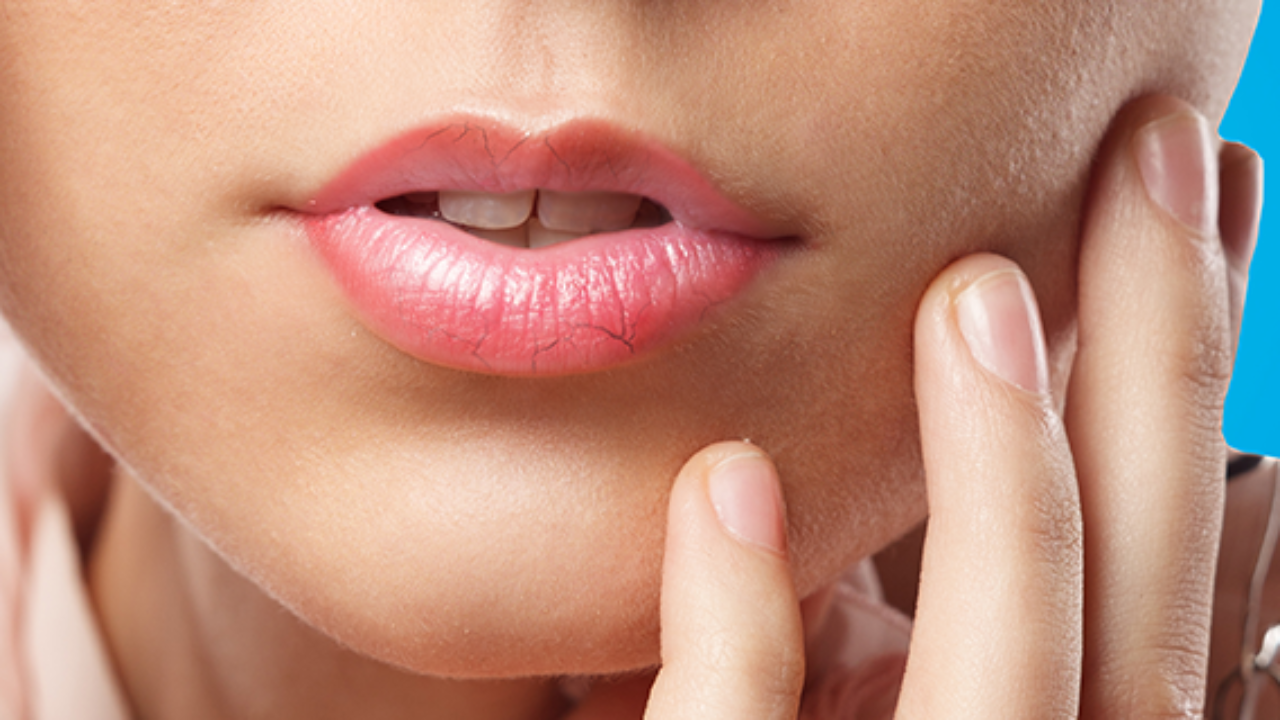 Tips Mengatasi Bibir Kering Dan Bibir Pecah Secara Alami Efektif Sukoharjonews Com