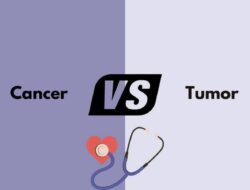 Kenali Perbedaan Tumor dan Kanker Payudara Disini!