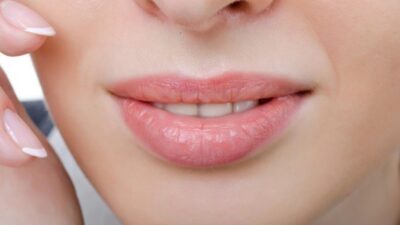 Simak Inilah Cara Mengatasi Bibir Pecah-Pecah