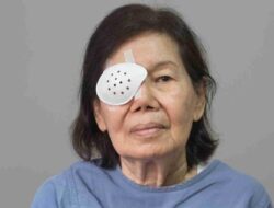 Waspada, Inilah Gejala Katarak yang Sering Jarang Disadari