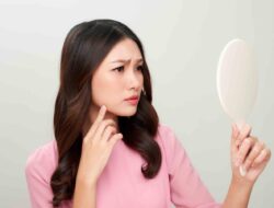 Bahan-bahan Skincare yang Dapat Membuat Wajah Gatal yang Perlu Kamu Waspadai!