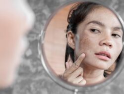 Muncul Jerawat Setelah Memakai Serum? Simak Ciri Lain Tak Cocok Memakai Serum!