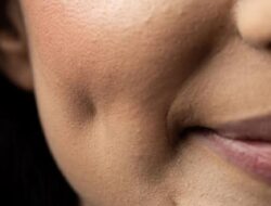 Berikut Fakta Tentang Lesung Pipi yang Tidak Banyak Orang Tahu