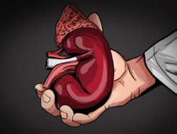 Waspada, Kebiasaan Ini Dapat Sebabkan Penyakit Batu Ginjal