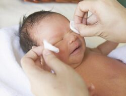 Penyebab Mata Bayi Belekan yang Wajib Abda Waspadai