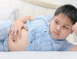 Fakta Tentang Obesitas Anak yang Perlu Diwaspadai