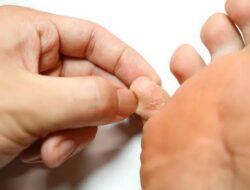 Simak Berikut Penyebab Kutu Air Pada Kaki
