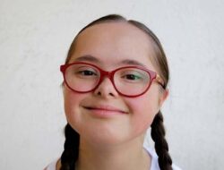 Gejala, dan Penyebab Mata Sipit