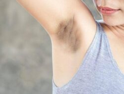 5 Tips Mengatasi Ketiak Gelap, Ternyata Mudah