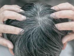 Cara Terbaik Menghentikan Rambut Beruban