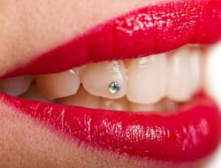 Penyebab Gigi Sensitif dan Cara Mengatasinya