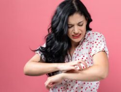 7 Minyak Esensial untuk Psoriasis yang Akan Meredakan Gejalanya