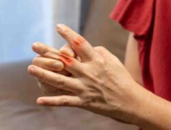 5 Alasan Mengapa Mengontrol Kadar Asam Urat Wajib untuk Kesehatan yang Baik