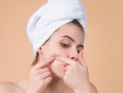 Perlu Anda Ketahui, Beriku Ini 5 Cara Mudah Menghilangkan Komedo di Pipi