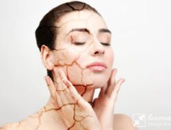 7 Solusi Rumahan untuk Mengatasi Kulit Kering dan Mengelupas