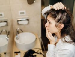 Jika Anda Khawatir dengan Area Botak, Cobalah Pengobatan Rumahan Ini untuk Pertumbuhan Rambut