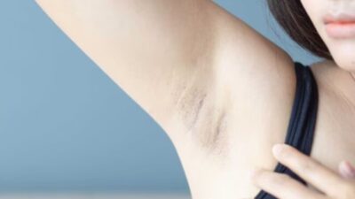 Ingin Membebaskan Diri dari Ketiak Gelap, Simak Tipsnya Berikut Ini