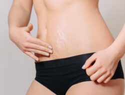 Ahli Dermatologi Ungkapkan 4 Pengobatan Rumahan Efektif untuk Mengurangi Stretch Mark Setelah Kehamilan