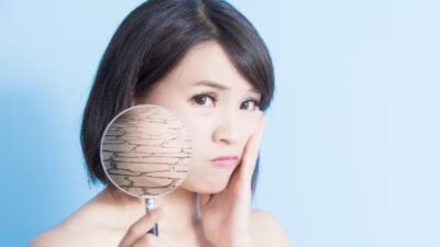 6 Ramuan Rumahan Ini akan Membantu Anda Mengatasi Kulit Kering di Musim Dingin