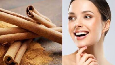 5 Cara Menakjubkan Menggunakan Kayu Manis untuk Kulit Sehat dan Bercahaya