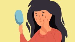5 Pengobatan Rumahan Ini Membantu Menyembuhkan Jerawat Hormonal yang Tak Terkendali