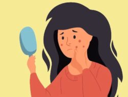 5 Pengobatan Rumahan Ini Membantu Menyembuhkan Jerawat Hormonal yang Tak Terkendali