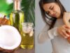 Minyak Kelapa: Apakah Ini Pengobatan Rumahan yang Efektif untuk Psoriasis? Ini Penjelasannya