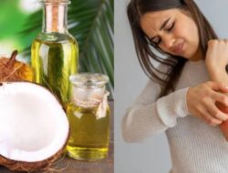 Minyak Kelapa: Apakah Ini Pengobatan Rumahan yang Efektif untuk Psoriasis? Ini Penjelasannya