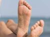 7 Cara Alami Terbaik untuk Menghilangkan Kulit Kaki yang Menggelap Akibat Sinar Matahari