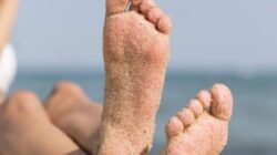 7 Cara Alami Terbaik untuk Menghilangkan Kulit Kaki yang Menggelap Akibat Sinar Matahari