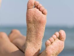 7 Cara Alami Terbaik untuk Menghilangkan Kulit Kaki yang Menggelap Akibat Sinar Matahari