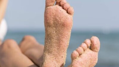 7 Cara Alami Terbaik untuk Menghilangkan Kulit Kaki yang Menggelap Akibat Sinar Matahari