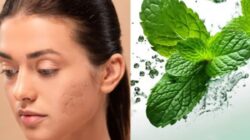 Berikut Ini 5 Cara Sederhana Menggunakan Daun Mint untuk Mengurangi Bekas Jerawat