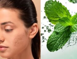 Berikut Ini 5 Cara Sederhana Menggunakan Daun Mint untuk Mengurangi Bekas Jerawat