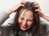 7 Cara Alami Mengatasi Kulit Kepala Kering
