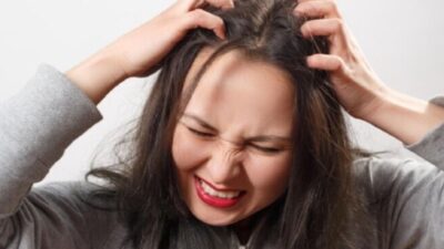 7 Cara Alami Mengatasi Kulit Kepala Kering