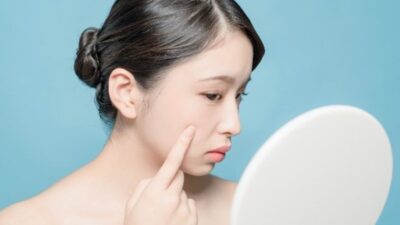 Rekomendasi Dokter Kulit yang Membantu Anda Mengatasi Kulit Kering Secara Alami
